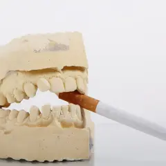 Modèle dentaire avec une cigarette. Le vapotage sans nicotine et les dents, une image qui fait réfléchir.