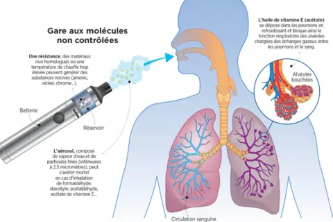 Le vapotage peut causer des douleurs thoraciques dues à l'inhalation de substances nocives et à l'obstruction des alvéoles pulmonaires.