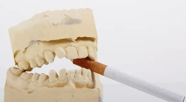 Modèle dentaire avec une cigarette. Le vapotage sans nicotine et les dents, une image qui fait réfléchir.