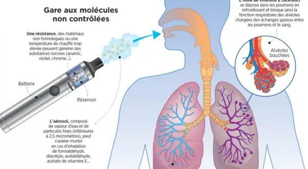 Le vapotage peut causer des douleurs thoraciques dues à l'inhalation de substances nocives et à l'obstruction des alvéoles pulmonaires.