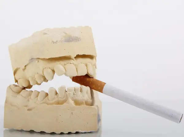 Modèle dentaire avec une cigarette. Le vapotage sans nicotine et les dents, une image qui fait réfléchir.